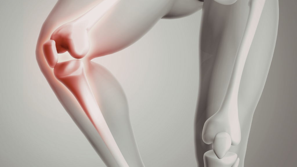 ecografía musculoesquelética