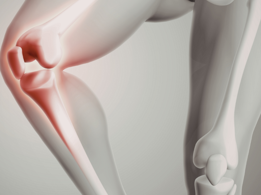 ecografía musculoesquelética